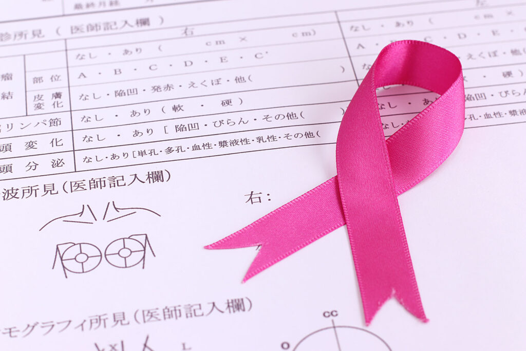 乳がん検診について。あなたの健康を守るために。